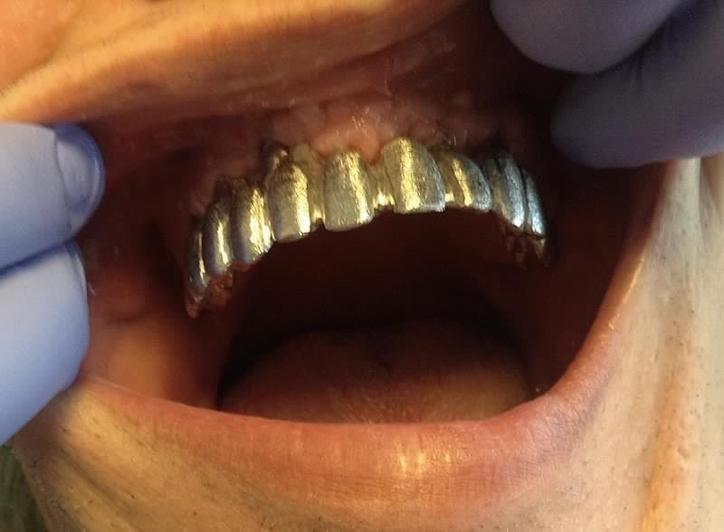 implantatum 10